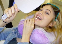 cynthia teeth whitening at archer dental in Toronto