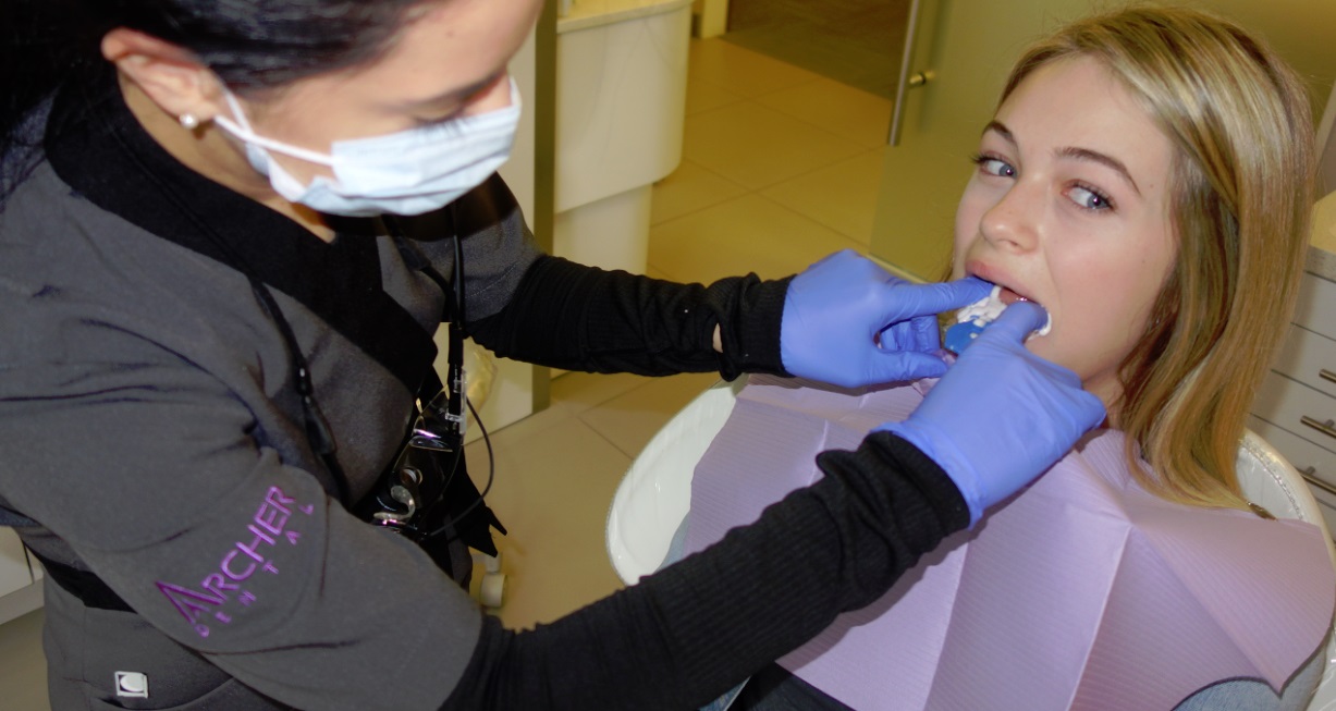 teeth whitening at Archer Dental