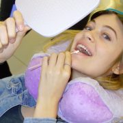 cynthia teeth whitening at archer dental in Toronto